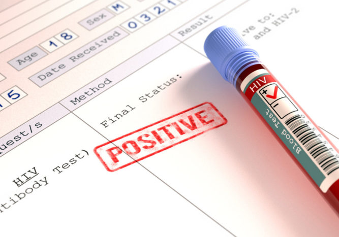 ایچ آئی وی انفیکشن کے ابتدائی علامات کو تسلیم