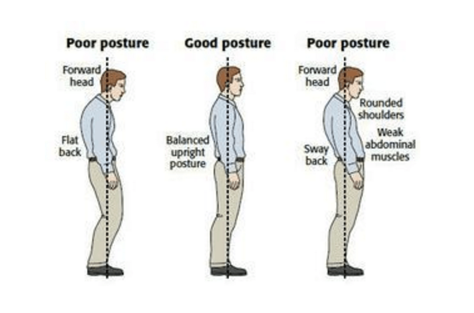 تصویری ذریعہ: http://www.thephysiocompany.com/blog/stop-slouching- پوسٹولیکل- ڈسینشن-symptoms-causes-and-treatment-of-bad- پوسٹسٹ