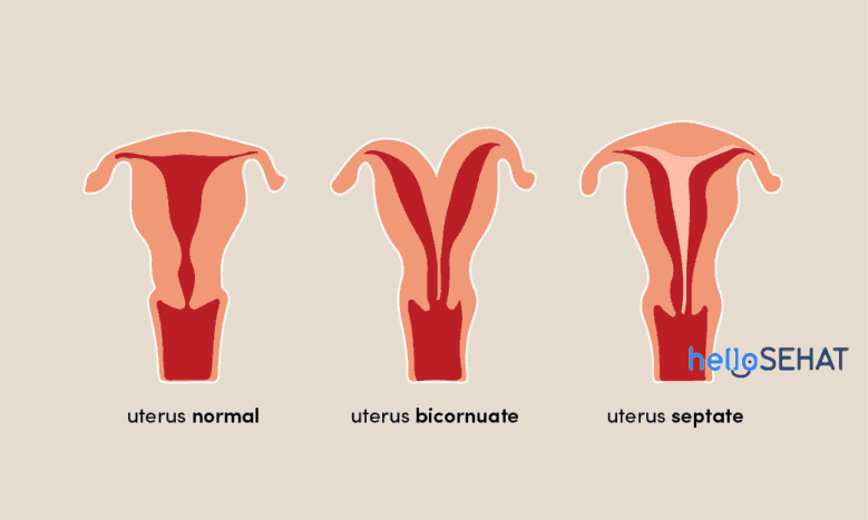 uterus میں غیر معمولی
