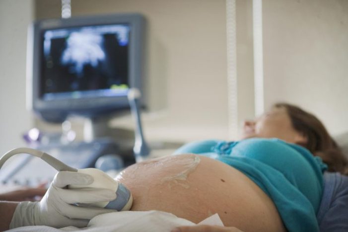 حاملہ خواتین کے لئے غیرسٹریس ٹیسٹ (این ٹی ایس)