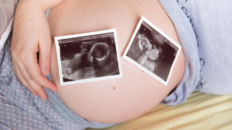 جڑواں بچوں کے ساتھ حاملہ ہونے کا خطرہ غائب ہو جاتا ہے