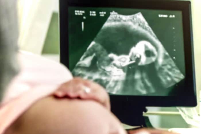 حاملہ خواتین کی اسکریننگ