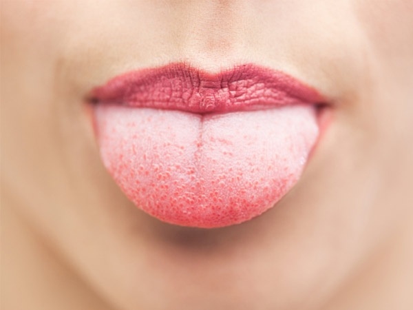 زبان کا رنگ بیماری کی نشاندہی کرتا ہے